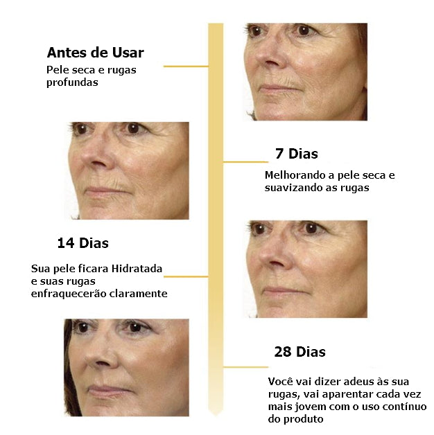 Breylee BasiKee retinol colágeno essência remove rugas anti envelhecimento rosto cuidados com a pele desaparecer linhas de expressão 100% natural.