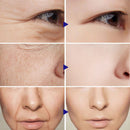 Breylee BasiKee retinol colágeno essência remove rugas anti envelhecimento rosto cuidados com a pele desaparecer linhas de expressão 100% natural.