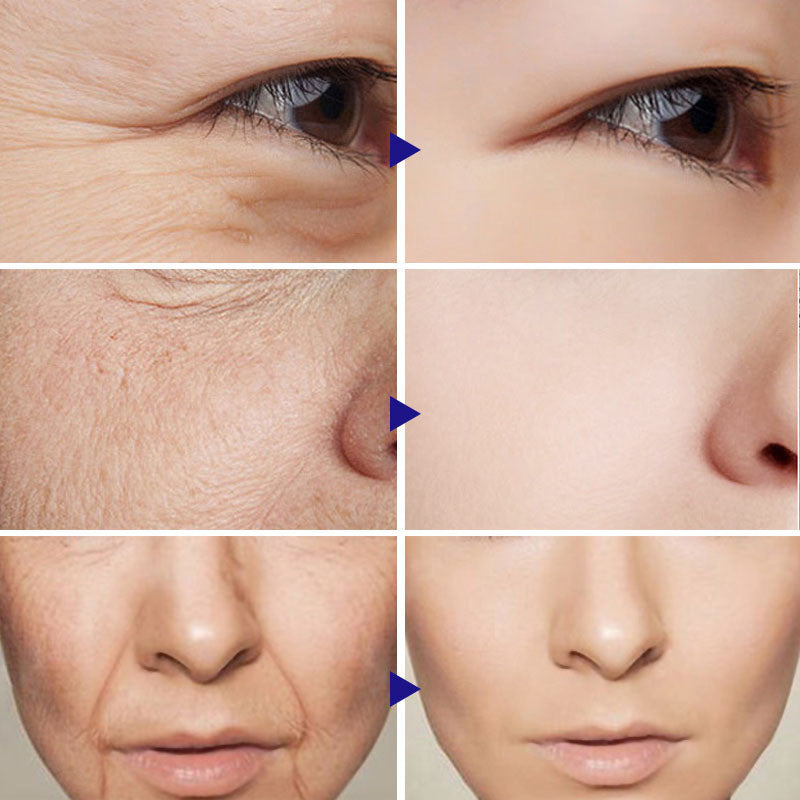Breylee BasiKee retinol colágeno essência remove rugas anti envelhecimento rosto cuidados com a pele desaparecer linhas de expressão 100% natural.